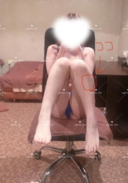 脛をぶつけた