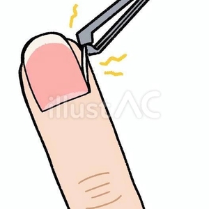 ささくれ注意⚠️