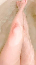 何かと話題の蚊だけど…